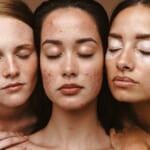 どんな状態でも、自分の肌と生きる。スキンポジティブ・ニュートラルの考え方で「美」を捉え直す width=